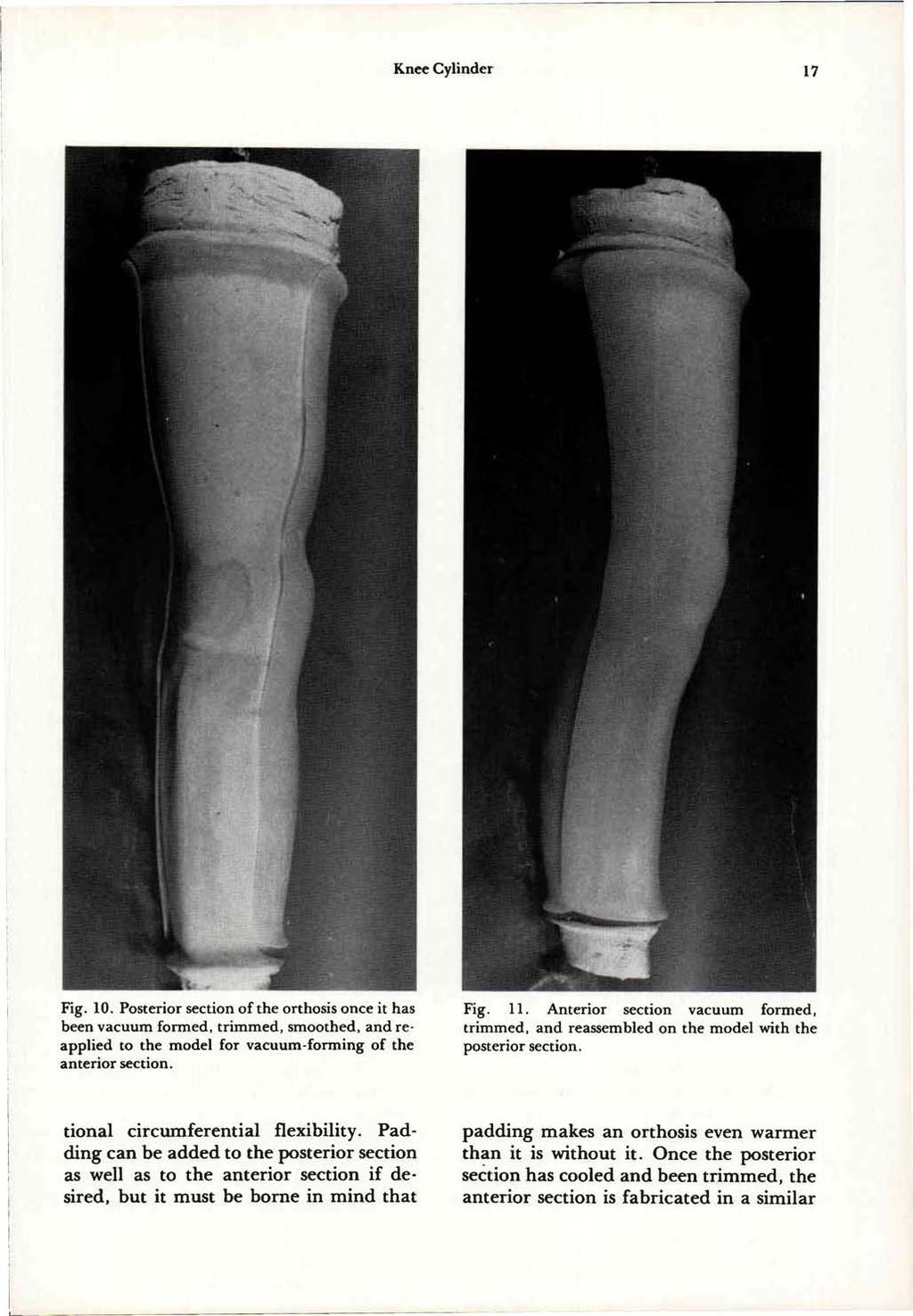 Fig. 10. Posterior section of the orthosis once it has been vacuum formed, trimmed, smoothed, and reapplied to the model for vacuum-forming of the anterior section. Fig. 11.