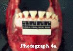 5 of 9 7/11/2012 11:29 AM incisors.