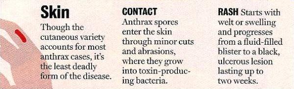 Anthrax