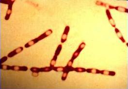 Bacillus anthracis: Anthrax Gram + bacillus spore forming capsule nonmotile aerobic formerly common; now rare in U.S.