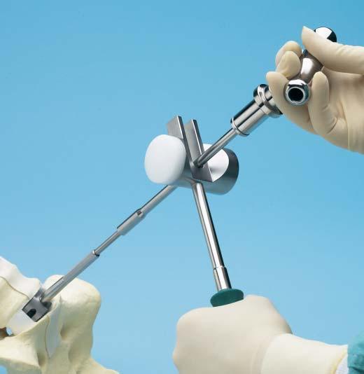 It is essential to use the tallest clinically reasonable implant to maximize segment stability.