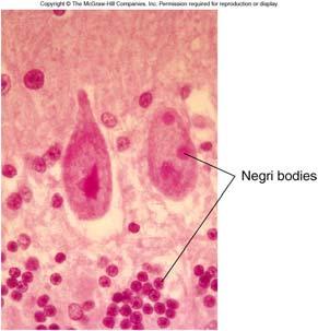 intracytoplasmic inclusions (Negri bodies) 33
