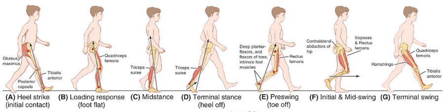 Observation of pwpd gait o Reduced arm swing and step length o Unilateral or bilateral foot drop / scuffing o slow shuffling gait / festination o Difficult to initiate walking, may stop