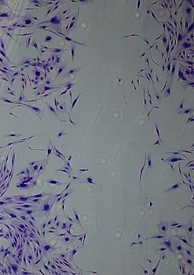free DMEM & incubated with fibroblasts G H I