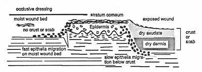 Epidermal cells migrate only over viable tissues as they require a blood and nutritional supply that is adequate to meet their
