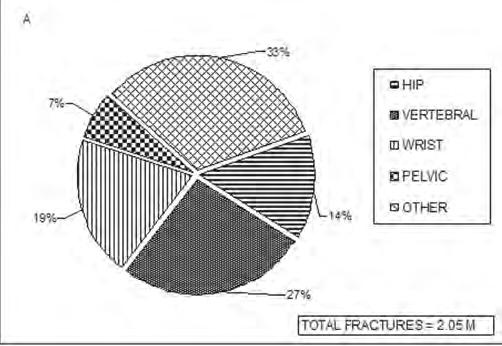OSTEOPOROSIS osteoporosis in 2005 in USA is estimated to increase from 10 million to >14 million