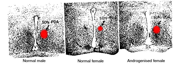 Sexually Dimorphic Nucleus of the Preoptic Area 5-7 times larger in