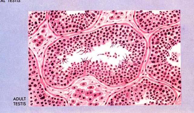 Testicular Histology Testis is made up of 2 major compartments 1) Region inside seminiferous