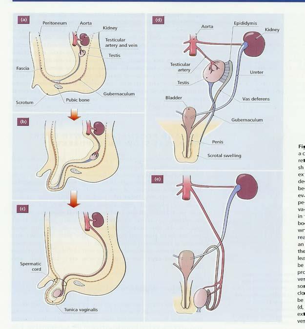 Models for testicular migration Testis is firmly attached to abdominal wall by: 1) Posterior gonad ligament (Gubernaculum) -