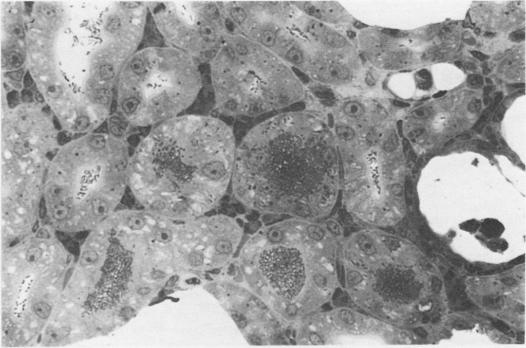Most of the tubular casts are colonies of bacteria as illustrated in Fig. 2. (H & E, X 140).... ~ FIG. 2. The kidney of a CVF-treated rat killed on day 2.