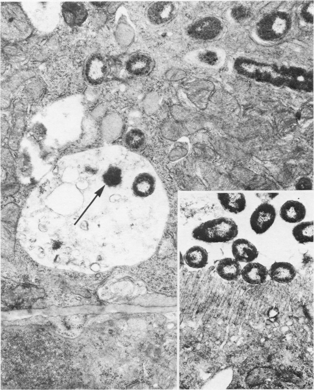PYELONEPHRITIS, COBRA VENOM FACTOR 271 FIG. 4. A proximal convoluted tubular epithelium of a CVF-treated rat killed on day 2. Several bacterial bodies are seen in the cytoplasm.