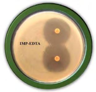 Rajasekar S. Vijayalakshmi and A. Mohankumar PLATE 2. Detection of Metallo -Lactamase by Imipenam EDTA Combined Disc Test PLATE 3.