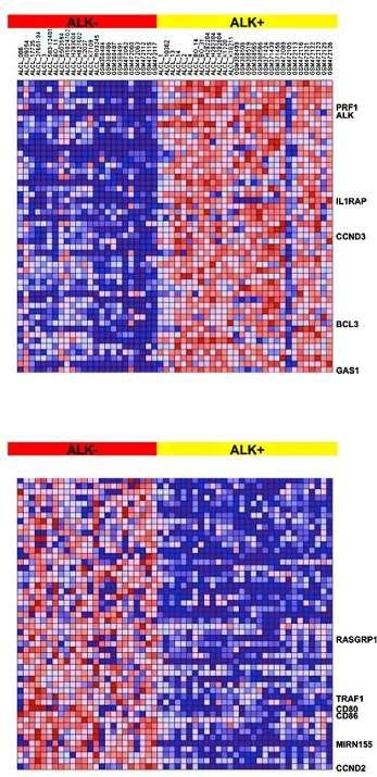 Results: cytokine expression in ALCL ALK+ vs. ALK- ALCL ALK+ vs. ALK- Cytokine Fold change (LogRatio) P-values NAP-2/CXCL7 2.69 0 BMP4 1.82 0 Siglec-5 1.50 2.00E-04 PDGF-BB 1.48 4.00E-04 IL-16 1.51 0.