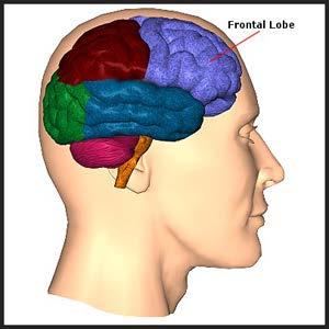 The frontal lobe experiences damage next. This causes problems with executive functioning.