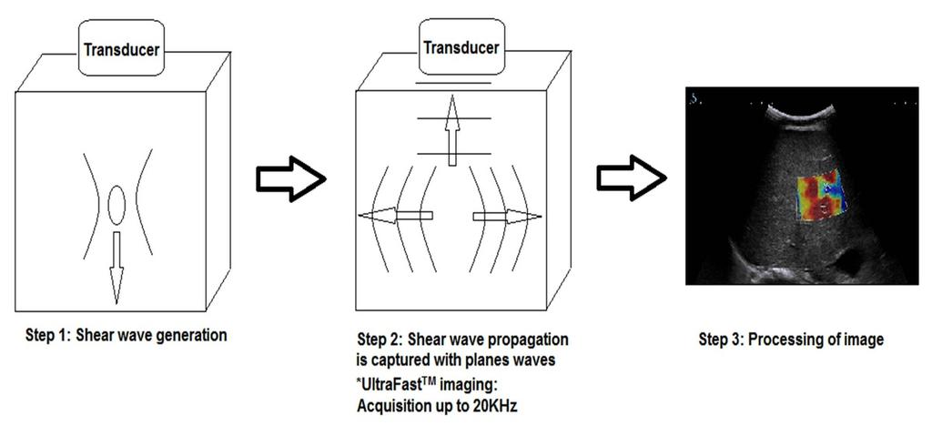 Fig. 1: Schematic diagram shows principles of supersonic SWE.