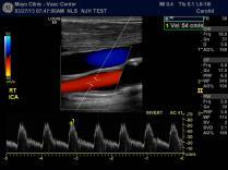 Compare median nerve SWE measurements from 2 scanners (2) Shear wave elastography imaging performance assessment New imaging mode + new testing tools + new methods Need for increased care and
