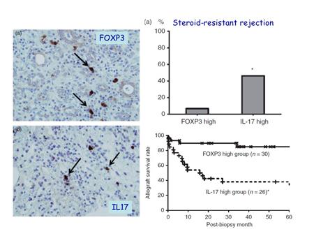 But in this study they also performed staining for FoxP3 disease, this transcription factor is characteristic for the regulatory T cells, so inducing tolerance and IL-17.
