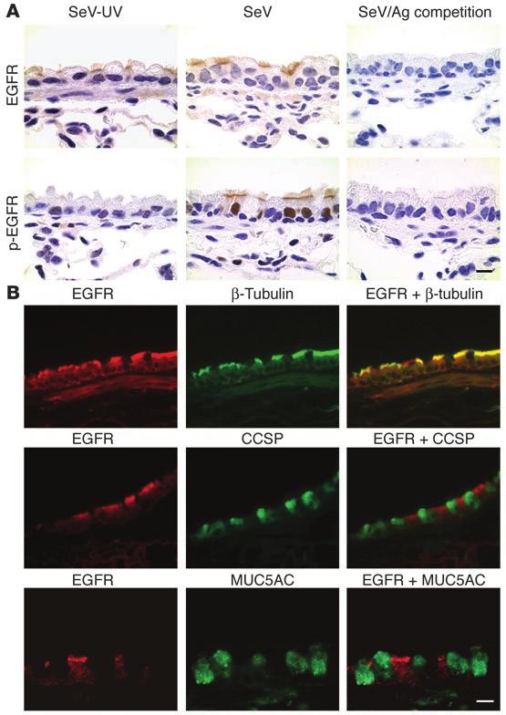 mucin gene expression (21), but studies of airway epithelial cells under physiologic conditions show that IL-13 fully stimulates goblet cell metaplasia despite EGFR blockade (5).