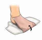 Eclypse Foot can be used under compression bandaging Wear time will depend on the