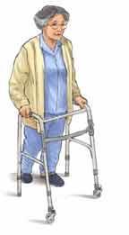 To protect your hip, avoid rotating your hip or foot. Step 2 Push down on the walker and let it support your weight.
