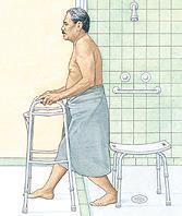 After Hip Replacement: Bathing Special shower chairs and tub benches are available for use while bathing.