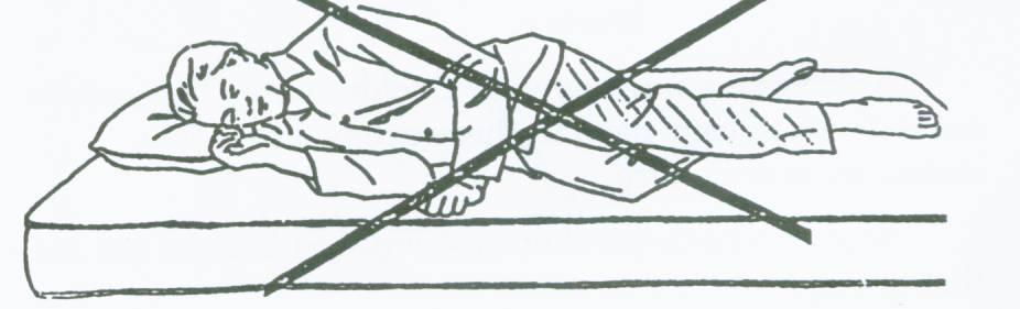 3. Do NOT twist on the operated leg (fig 11). 4.