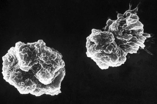 Pathogenic amoeba - Relatively few exist, but some are important. 1.