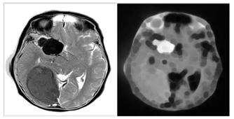 The MRI images of patients affected by Brain Cancer are used during Recognition/Testing phase.