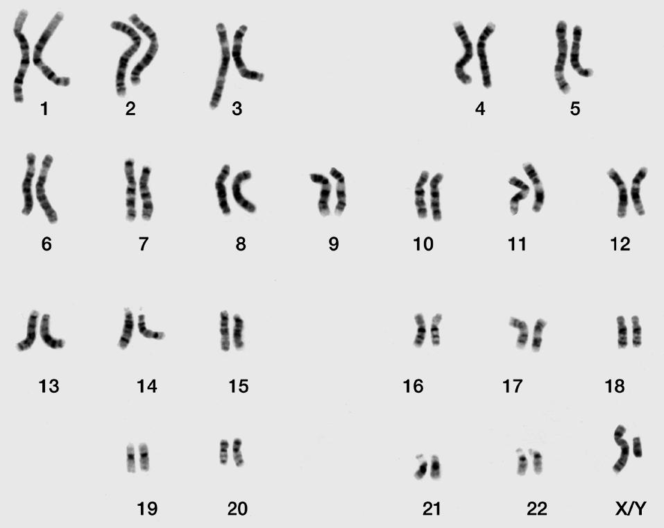 What are sex chromosomes?