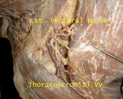 pectoral nerves