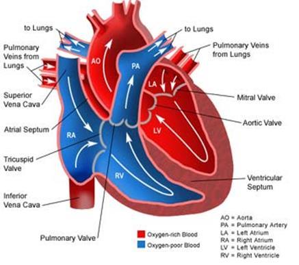 Right heart (Suction) poorly- oxygenated(venous) blood from the body superior vena cava & inferior vena cava right atrium right ventricle