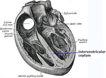membranous parts Bulges into the cavity of the right ventricle.