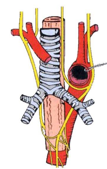 Three Veins: Left brachiocephalic vein Right brachiocephalic vein Superior vena cava