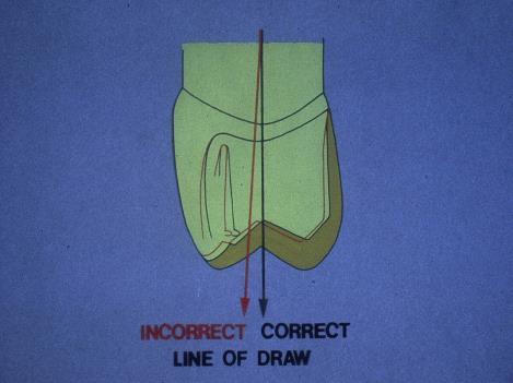 following the contour of the tooth holding