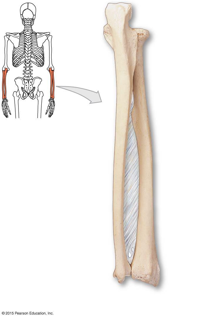Figure 8-5a The Right Radius and Ulna.