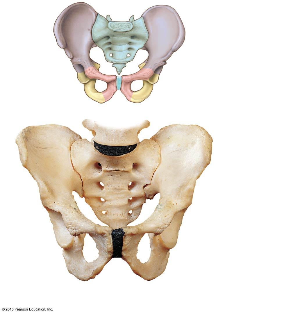 Figure 8-8a The Pelvis of an Adult Male.