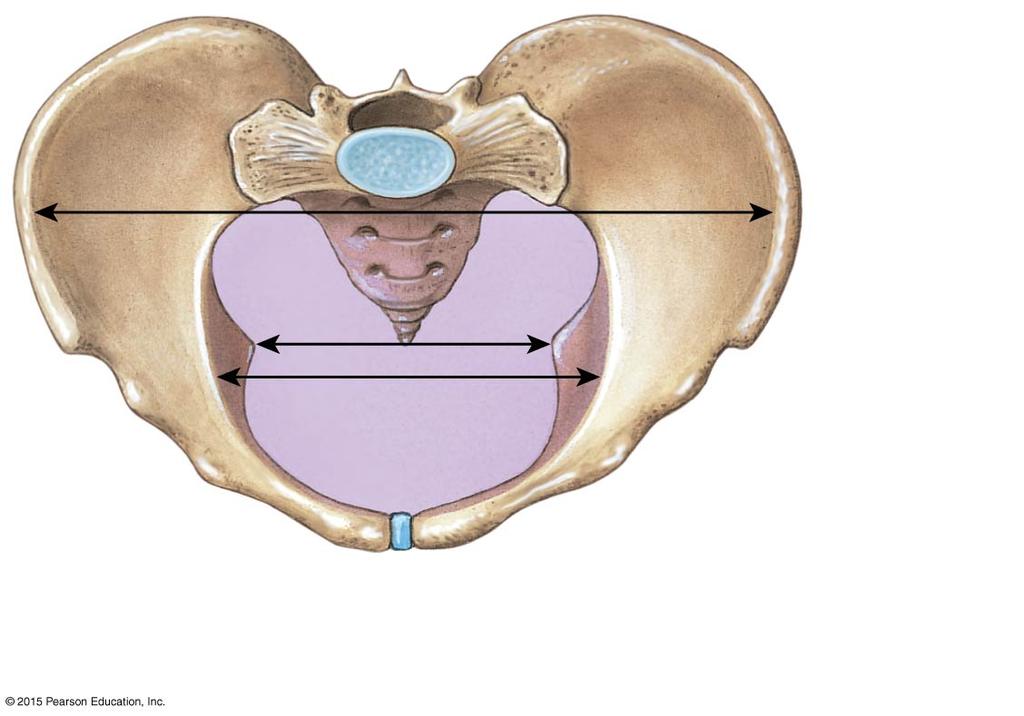 Figure 8-9a Divisions of the Pelvis.