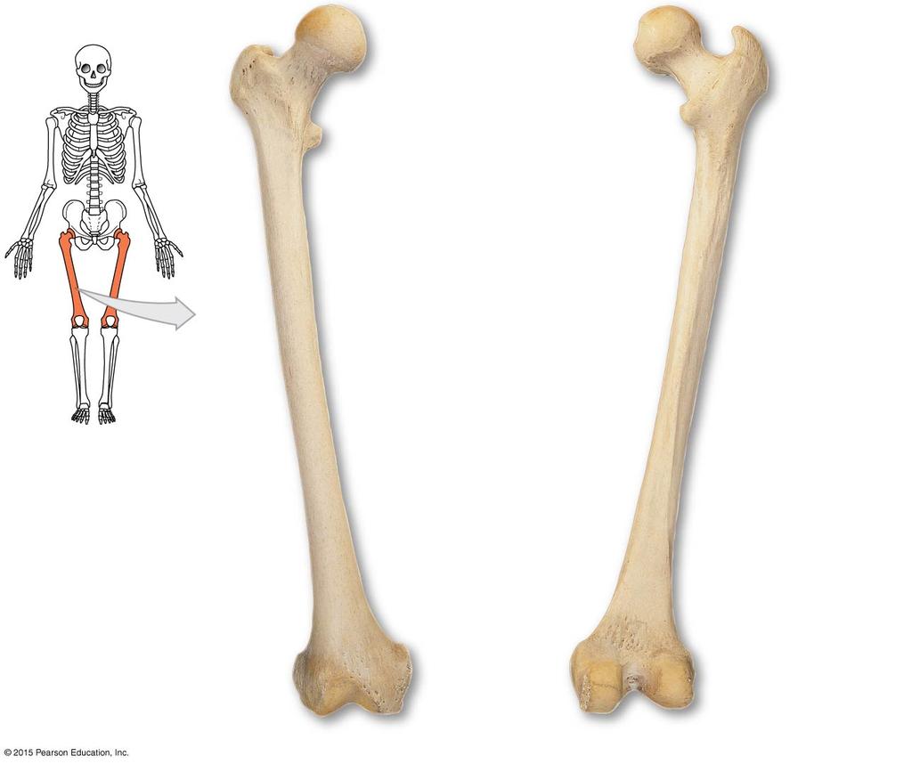 Figure 8-11 Bone Markings on the Right Femur.