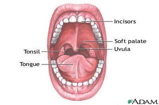 Relationship of Poor Oral Hygiene to Pneumonia Poor oral hygiene, profuse plaque development and a compromised immune host system provide