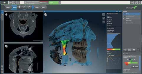 Today s integrated solutions give us a taste of tomorrow s innovative therapies Author Mark Bucher, Product manager 3D imaging, Bensheim (Germany) 1 Dentists analyze patient respiratory tracts and