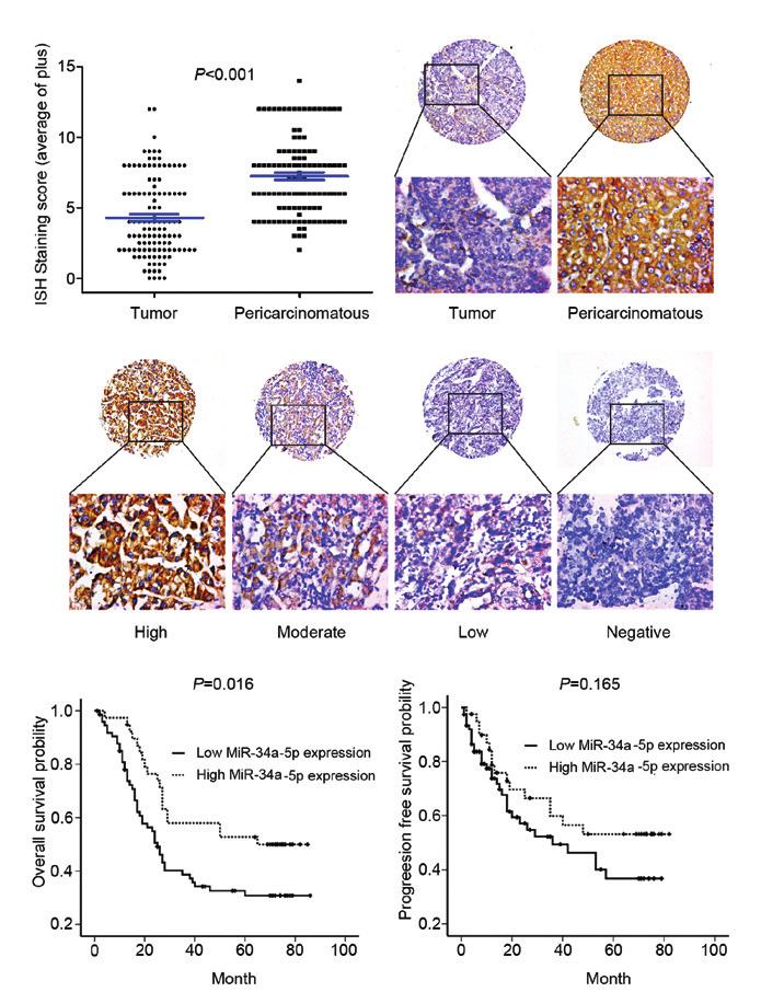 2694 LI et al: mirna34a-5p MODULATES THE SENSITIVITY OF CHEMOTHERAPY IN HCC CELLS A B C D E Figure 1. Expression of mirna 34a 5p in the microarray and survival analysis of HCC tissues.