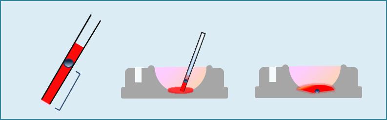 PART 3 Step 2 Dilution (3 min) 1. At the end of 1 min. aspirate the oocyte/embryo and 3mm long of TS into the pipette (Fig. 8.