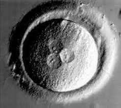 more than 1 sperm entered egg (polyspermy)