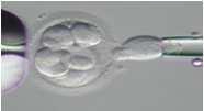 Trophectoderm -4q, -16 Embryo
