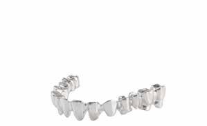 supported bridge Tooth-supported restoration From 2 to 14 components * Bridge on a