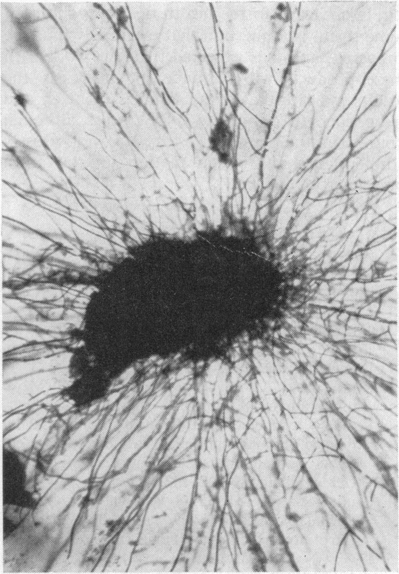 hr and examined microscopically through the bottom of the unopened dishes. From many particles of some samples, masses of hyphae had grown out in that short time, as shown in Fig. 2.