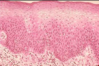 Stratified squamous Stratified Cuboidal Epithelium Sweat gland