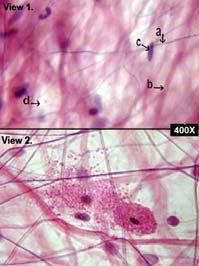 Areolar Areolar: what to look for Fibroblasts Collagen fibers