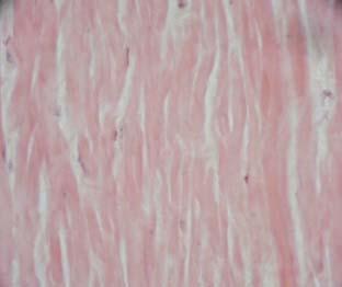 Elastic tissue Elastic tissue: what to look for Elastic fibers (instead of collagen