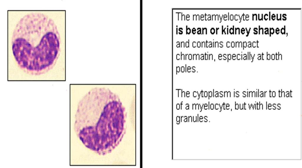 Metamyelocyte: When the nucleus becomes flattened and the chromatin